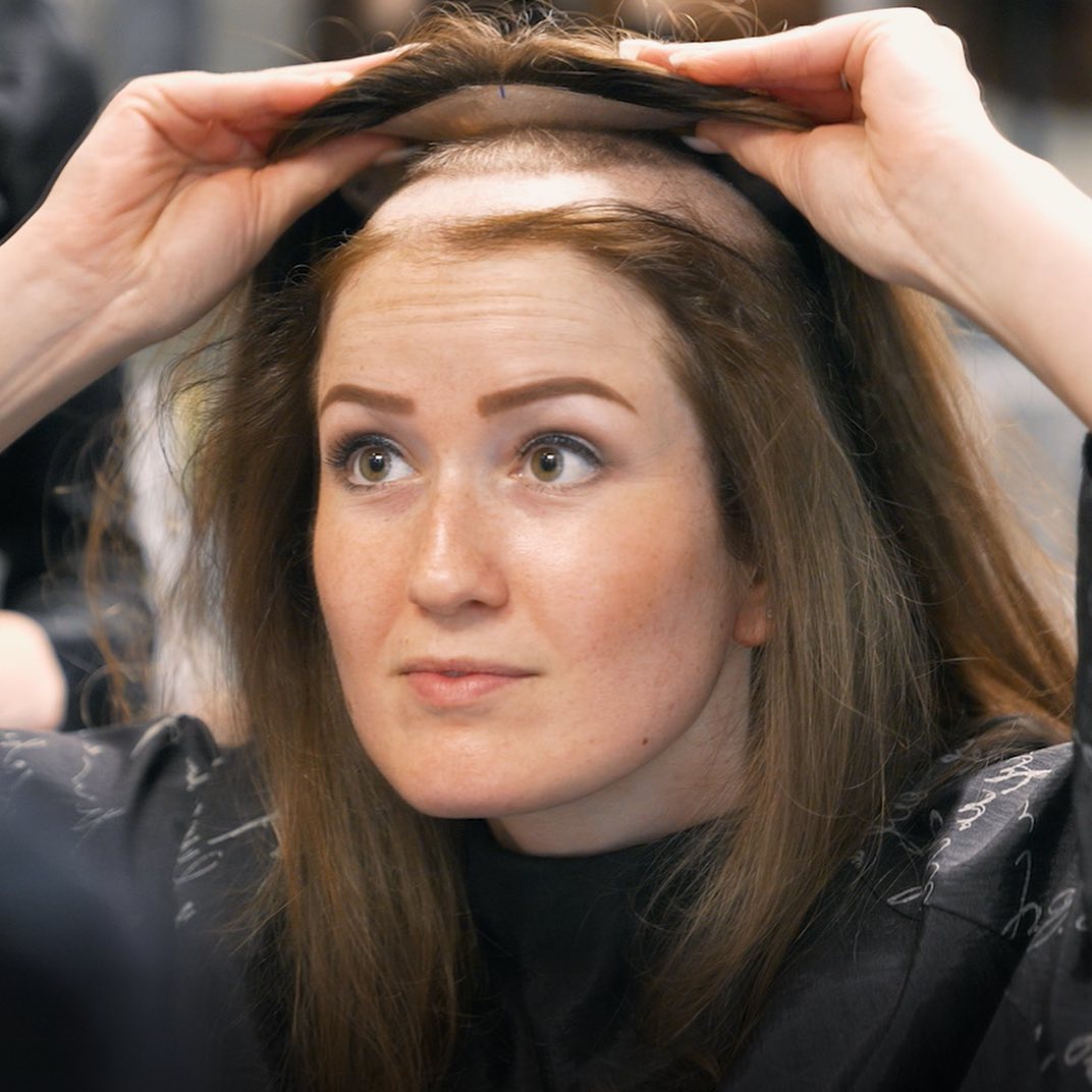 Impressie voor en na haarwerkspecialist